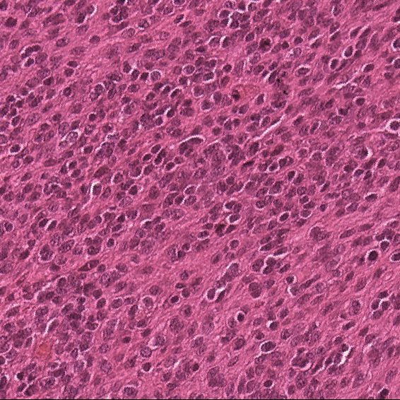 Cell Type 2