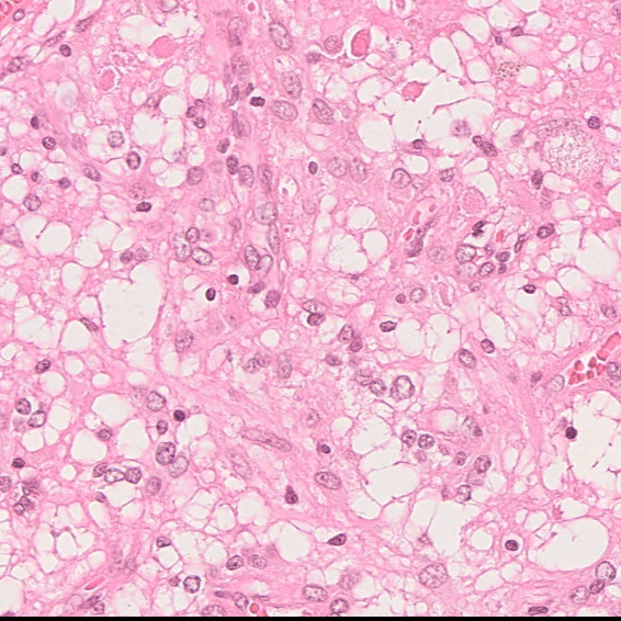 Cell Type 1