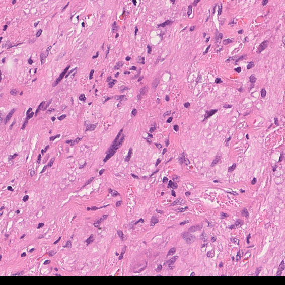 Cell Type 3